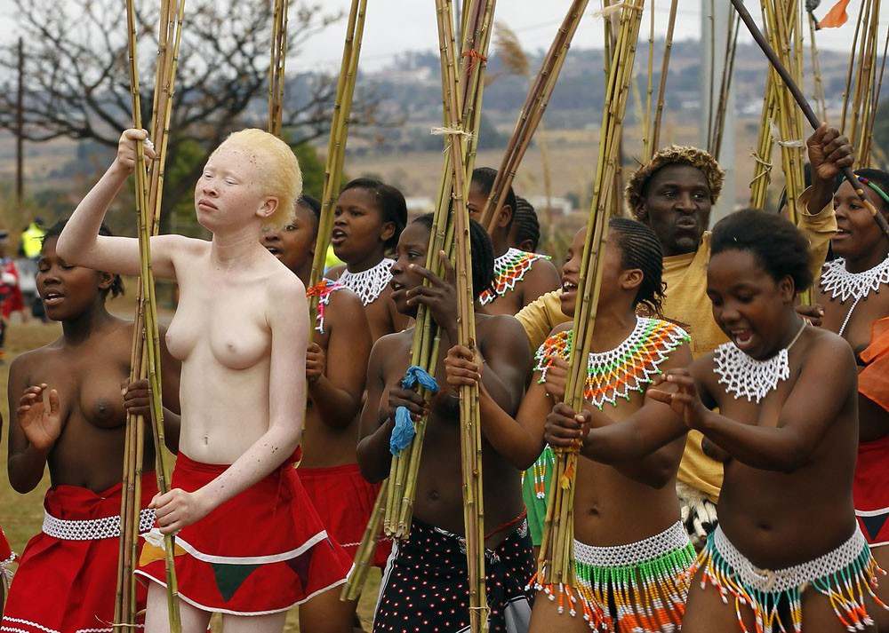 голая девушка папуаска альбинос